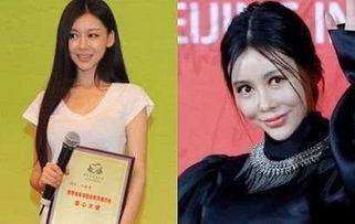 五個(gè)悔不該當(dāng)初去整容的女星,鄭爽上榜,網(wǎng)友 圖5真的太可惜了